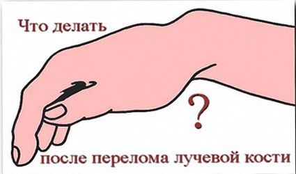 ЛФК при переломе лучевой кости.Среди всех известных переломов костей предплечья наиболее часто ...