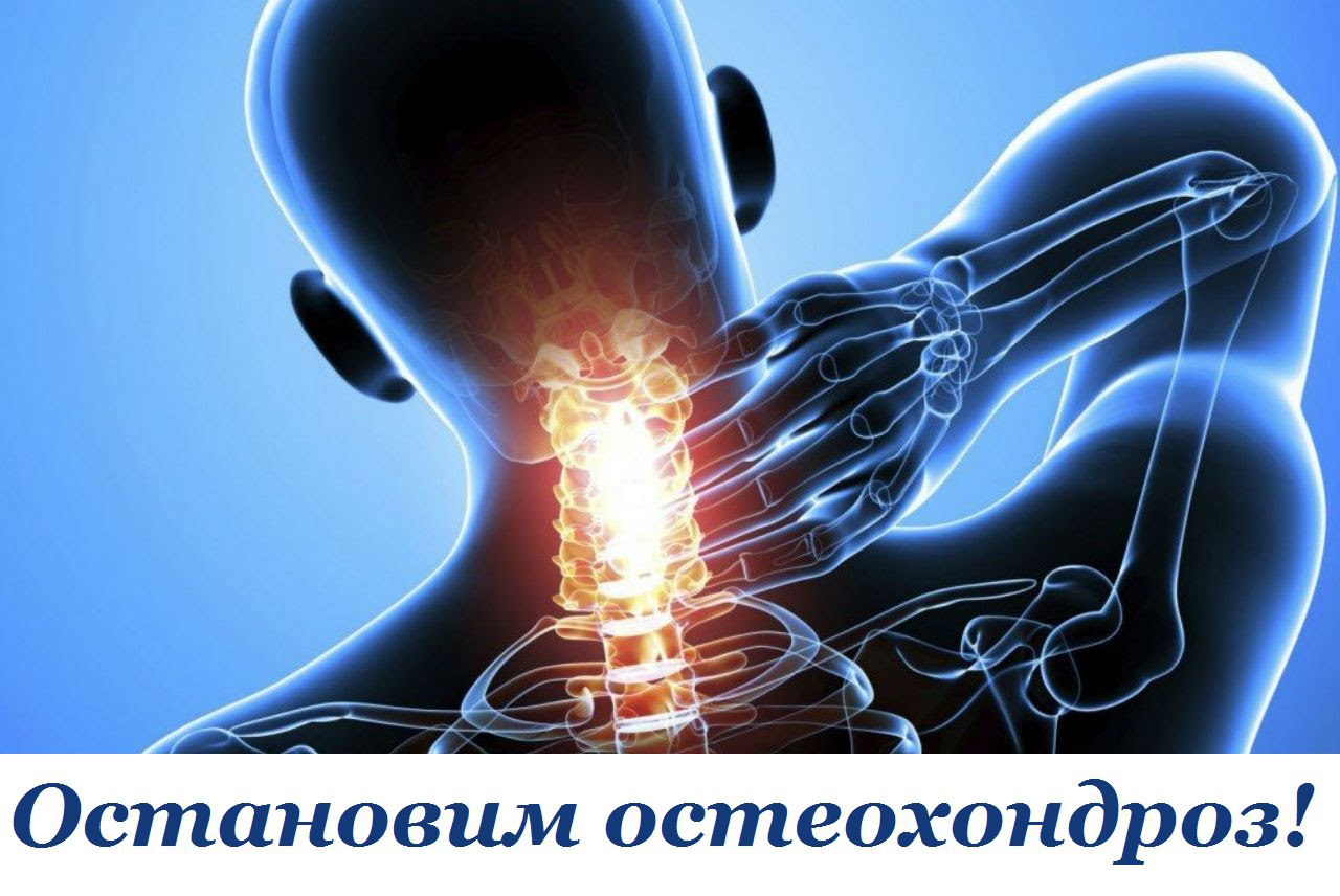 Остановим остеохондроз.Мне всегда казалось, если врачу не удается определить, в чем причина ...