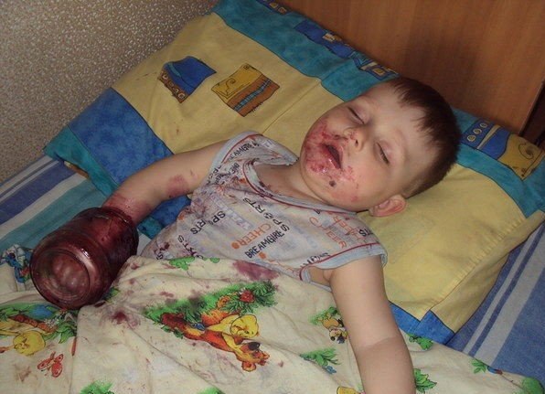 Передозировка