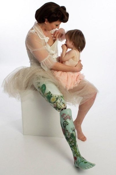 The alternative limb project:       ,   ... - 4