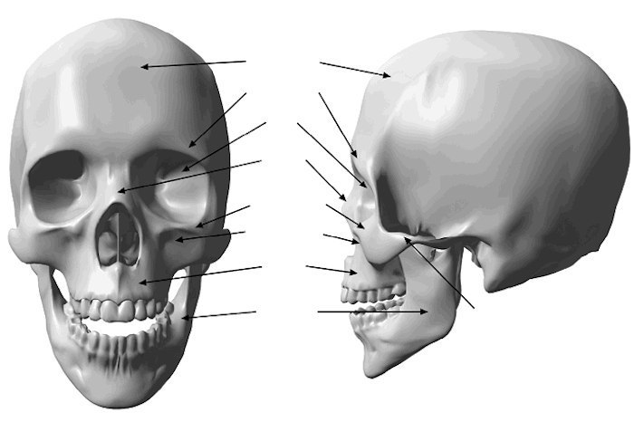 Верхняя скуловая кость. Носовая кость черепа анатомия. Скуловые кости черепа. Асимметрия лобной кости. Скуловая дуга на черепе.
