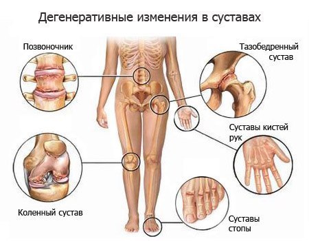 ЖЕЛАТИН ДЛЯ СУСТАВОВ.Часто мы сталкиваемся с такой проблемой, занимаясь спортом от постоянных ...