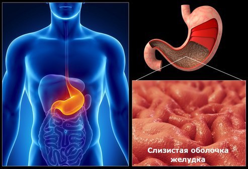 Болит желудок — успокойте нервы. Очень часто язва желудка возникает на фоне нервных срывов, ...