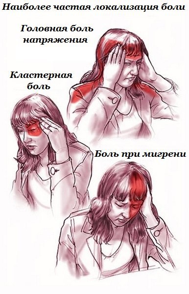 Самый эффективный метод лечения головной боли.Этот метод лечения головной боли очень редок, и вы ...