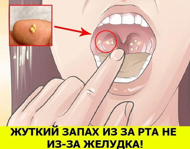��ac�o ������ ��o p�a?! ���� c��a�a�� 93% ���e�! �� ���� �� ������������� ���� �� ������� ��� ...