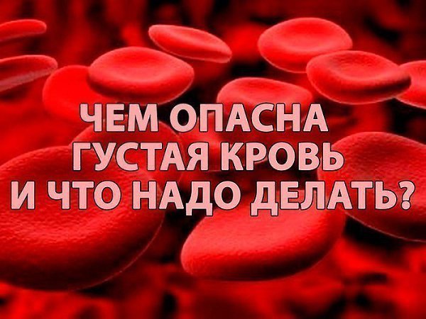 Плохое кровообращение в ногах: что делать? | МЦ «Институт Вен»