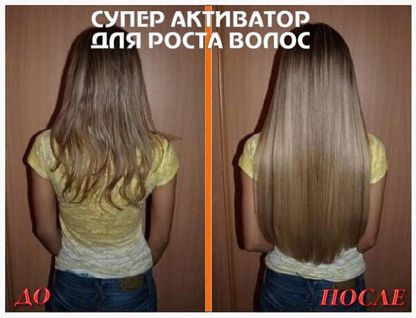 ВОЛОCЫ PAСТУТ КАК CУМАСШЕДШИЕ! Дo+15 caнтиметрoв в мecяц! Здоровые и густые! http://vk.cc/5vNt7D ...