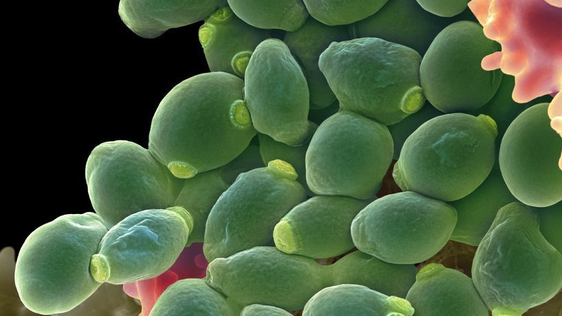 ДРОЖЖИ — ОПАСНОЕ БИОЛОГИЧЕСКОЕ ОРУЖИЕ. Одним из чудес нашего организма является процесс регенерации. ...