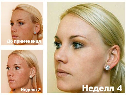 Как избавиться от пигментных пятен на руках и лице? http://media.smmhelp.me/BgdTw Популярное мнение, ...