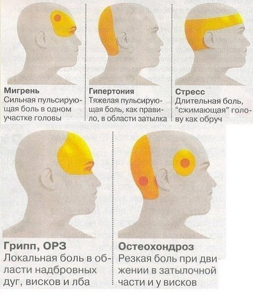 ЧЕМ ОПАСНА ГУСТАЯ КРОВЬ И ЧТО НАДО ДЕЛАТЬ? Некоторые знают, что густую кровь надо разжижать. ... - 5