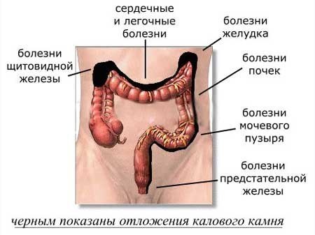 НУЖНА ЛИ ОЧИСТКА КИШЕЧНИКА НА САМОМ ДЕЛЕ? Часто, консультируя людей по разным проблемам, касающимся ...