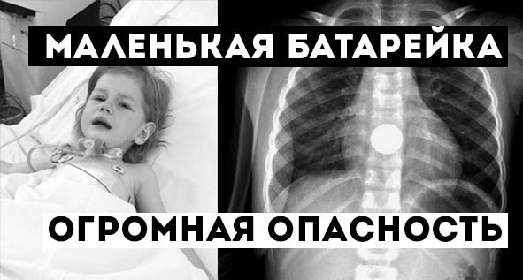 Друзья! Мы видим, что история маленькой Златы, проглотившей батарейку, многих не оставила ...