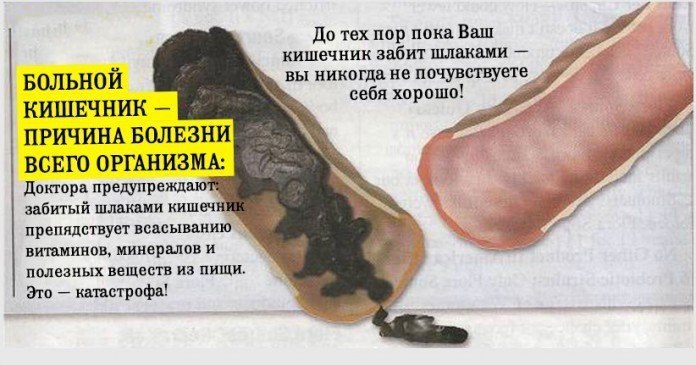 У вас около 9 кг ядов в прямой кишке — вот что вы можете сделать! Толстая кишка играет одну из самых ...