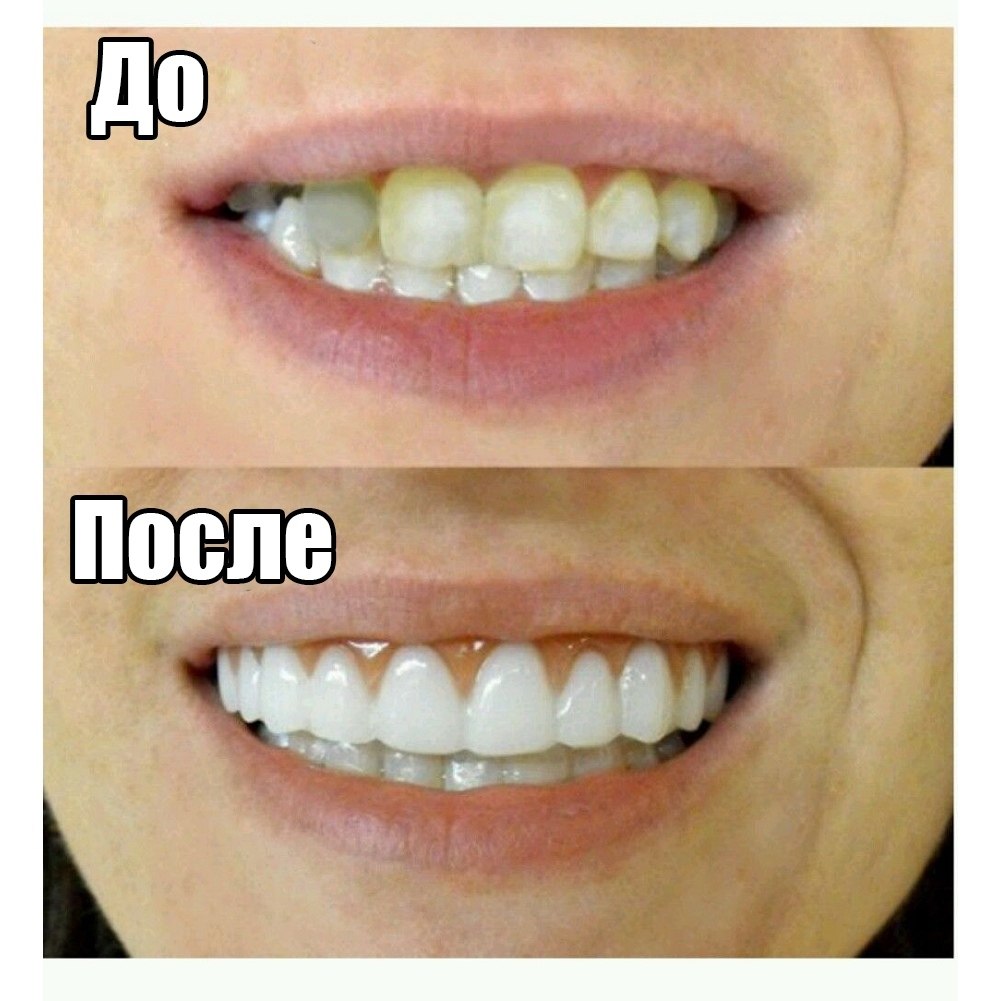    ?    ,   Perfect smile ... - 2