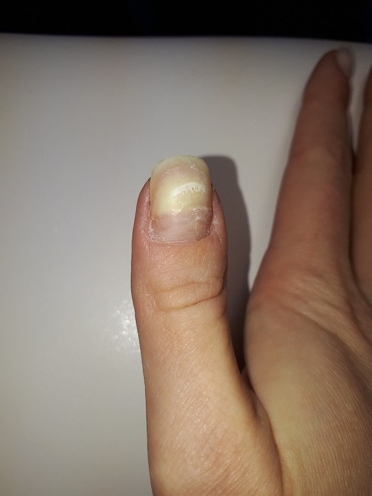 #Истории@modnailru.А я хочу рассказать позитивную историю)Гель-лак делаю всегда, без него мои ногти ...