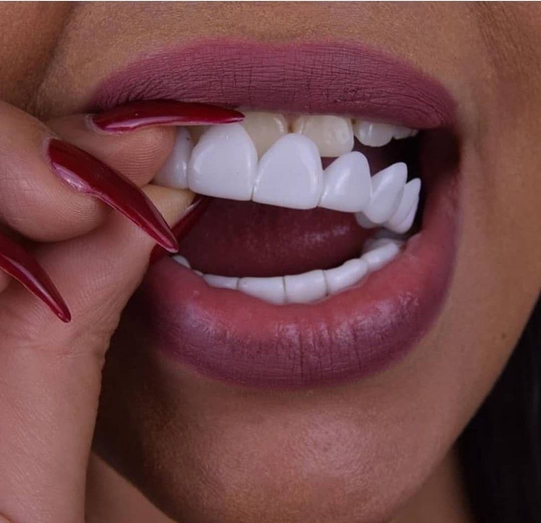     Perfect Smile Veneers!      . ...