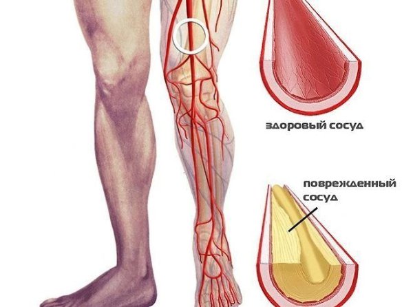 10 главных упражнений для тех, у кого нарушено кровообращение