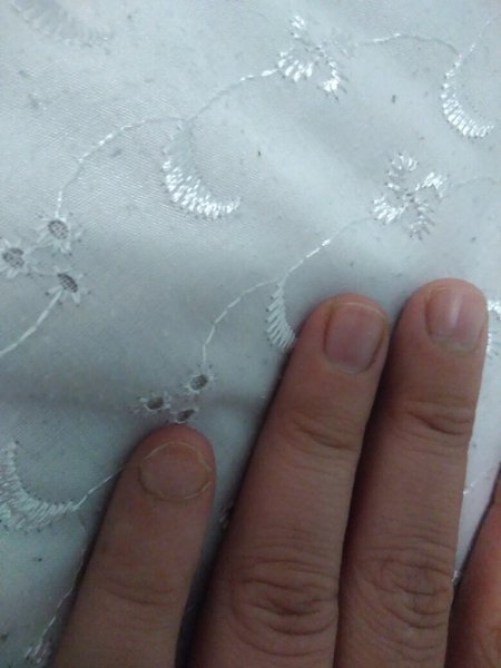 #истории@modnailru.Админ, опубликуй пожалуйста анонимно)После гель-лака с ногтем на мизинце ...