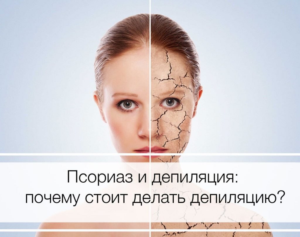 МОЖНО ЛИ ДЕЛАТЬ ШУГАРИНГ ПРИ ПСОРИАЗЕ | Уход за собой | Фотострана ...