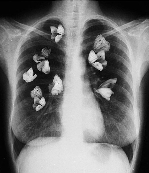 �� ����� �������