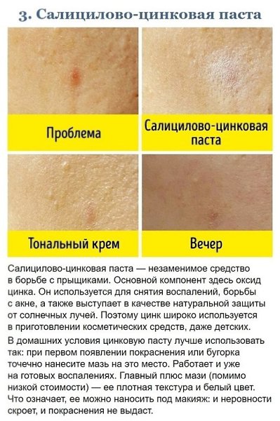 Бюджетные средства из аптеки, которые работают не хуже люксовых марок - 2