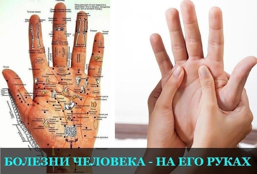 Как узнать какой болезнь. Заболевания по ладони. Болезни по руке человека. Болезни по ладоням рук. Определение болезни по руке человека.