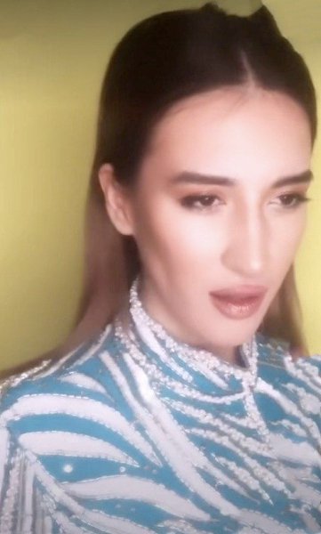 Блогерша из TikTok потратила много миллионов рублей, чтобы стать похожей на Ольгу Бузову.А стала ... - 4