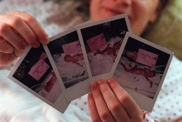 Эта пара удостоилась получить сразу четверное счастье.. У них родились четверняшки! - 2