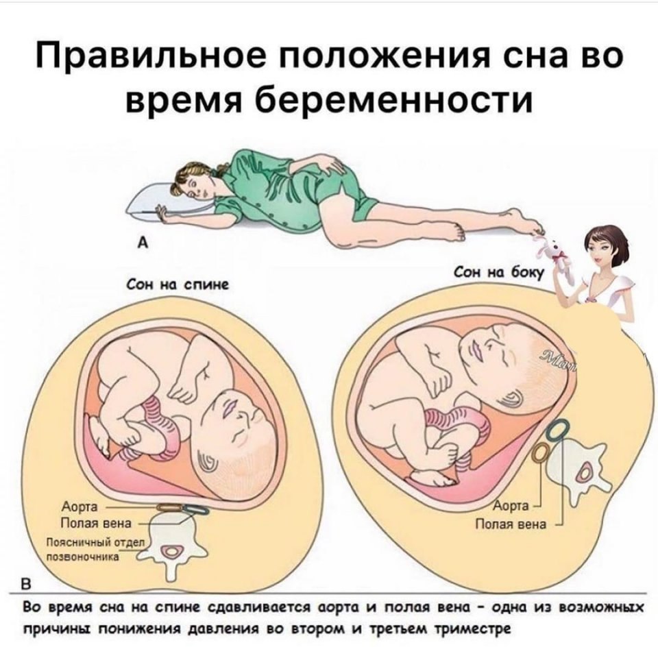 Позы для сна во 2 триместре беременности