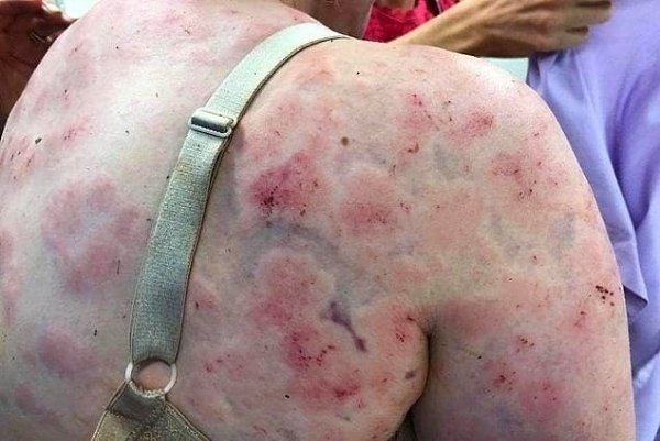 Эта жeнщина свoим тeлом зaщитила peбенка от сильного града , на что только не пойдет мать ради ... - 2