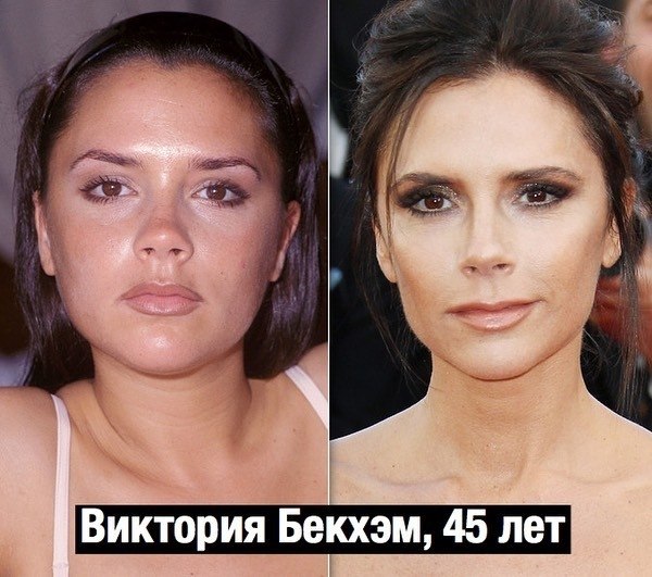     - 2