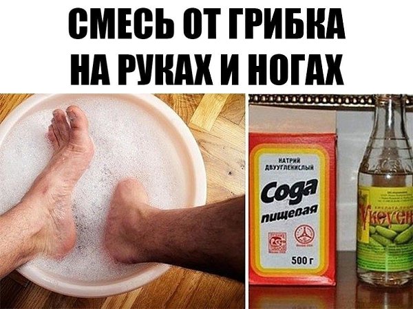 ГРИБОК НА НОГАХ И РУКАХ- СМЕСЬ. Грибок ногтей на ногах — это заболевание, которым страдают и ...