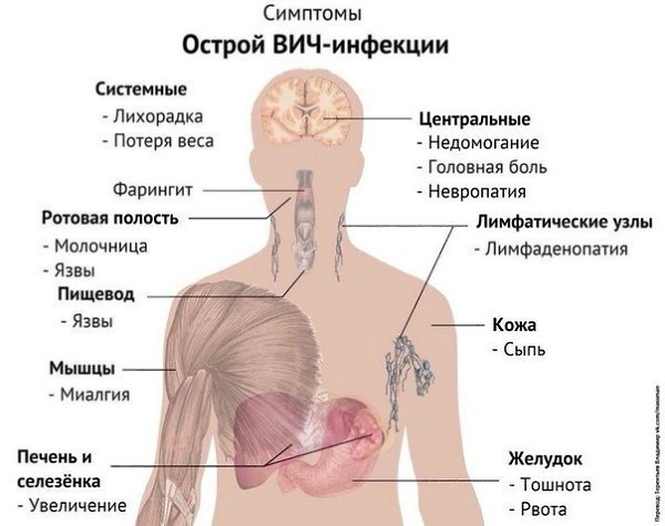 Специально для подписчиков, которым уже за 25 лет – симптомы заболеваний в понятных схемах: