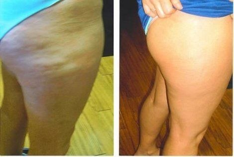 �������� ��������������� �����. ���� ������������ ��� ����� 4-6 ���� � ������ � ������� 2-3 �������, ...