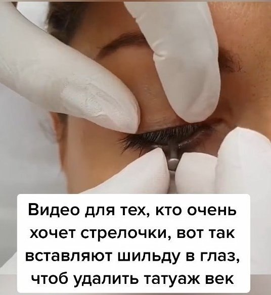 Как это страшно выглядит Я бы не рискнула пойти на такую процедуру! А Вы бы сделали себе татуаж ... - 4