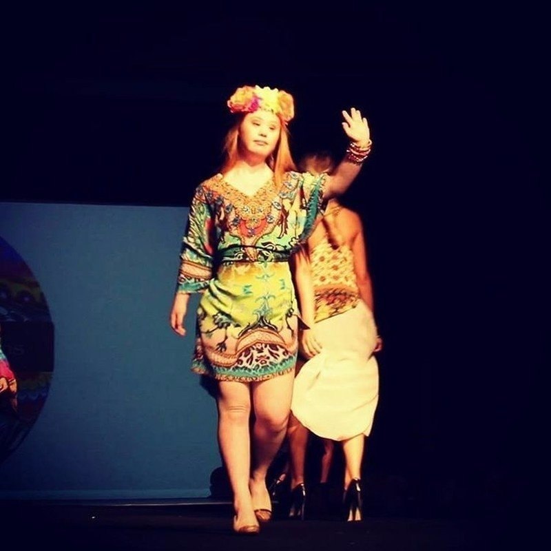 Синдромом Дауна не остановил девушку стать моделью. Уровень силы воли зашкаливает, умничка! - 4