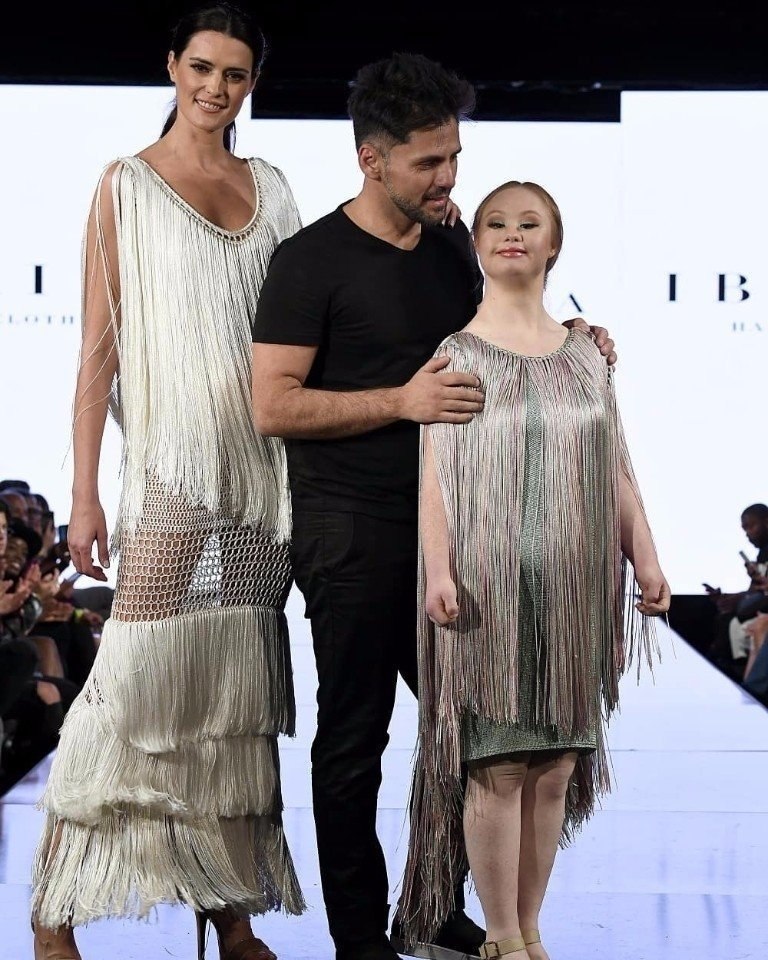 Синдромом Дауна не остановил девушку стать моделью. Уровень силы воли зашкаливает, умничка! - 5