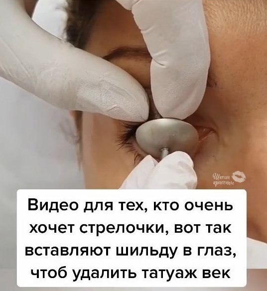 Как это страшно выглядит Я бы не рискнула пойти на такую процедуру! А Вы бы сделали себе татуаж ...
