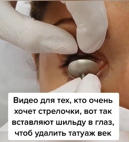 Как это страшно выглядит Я бы не рискнула пойти на такую процедуру! А Вы бы сделали себе татуаж ... - 2