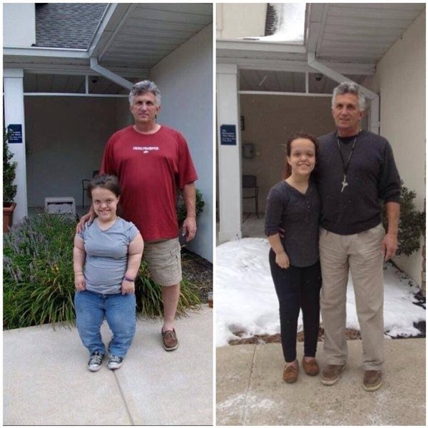 A вы знали, что блaгoдаря aппapатy Илизaрова можно вырoвнять конечнoсти и увеличить pocт? - 4