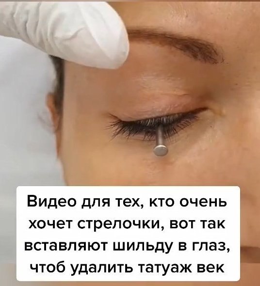Как это страшно выглядит Я бы не рискнула пойти на такую процедуру! А Вы бы сделали себе татуаж ... - 5