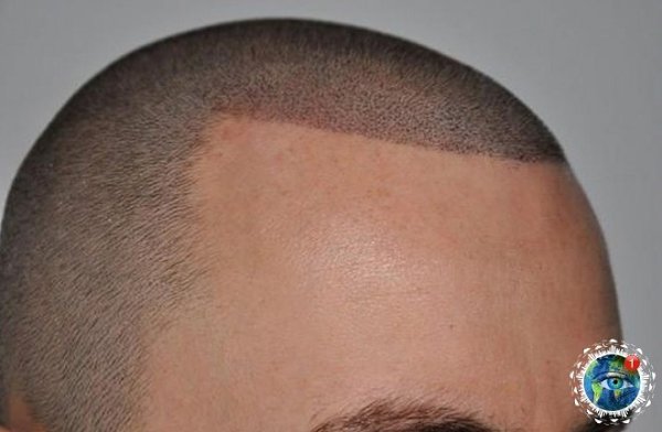 oee apo e a cec.  - 4