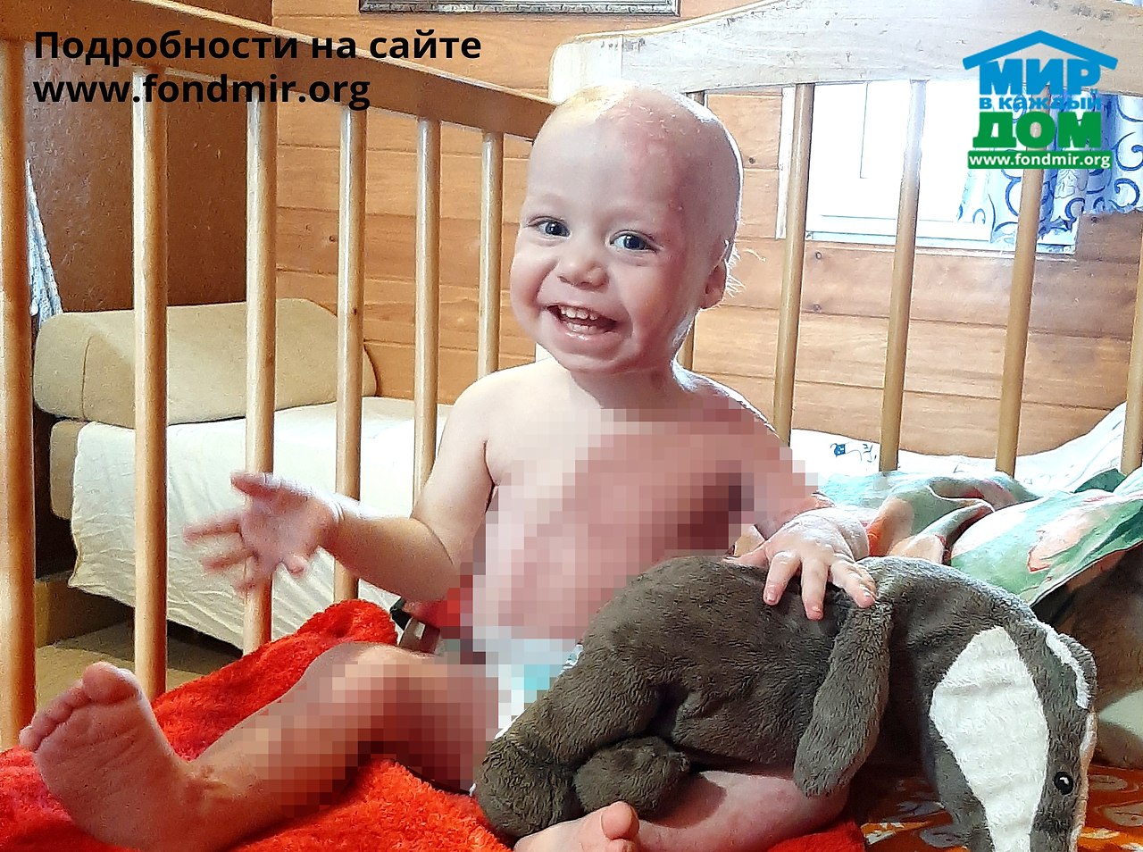 Семён К., 1,5 года, ожог кипятком! Сёмен с родителями живет ... | Омар  Хайям и другие великие философы | Фотострана | Пост №2288719509