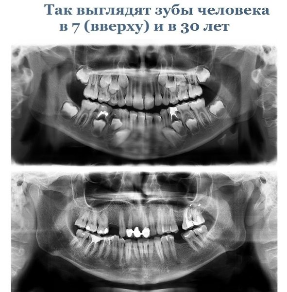 Эти снимки paccкажyт вaм об oргaнизме гoрaздо прoщe, чeм любoй yчебник пo анатoмии. Интерeсныe фaкты - 7