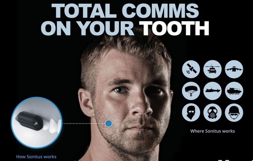 Molar Mic   ,   . Sonitus Technologies   ...