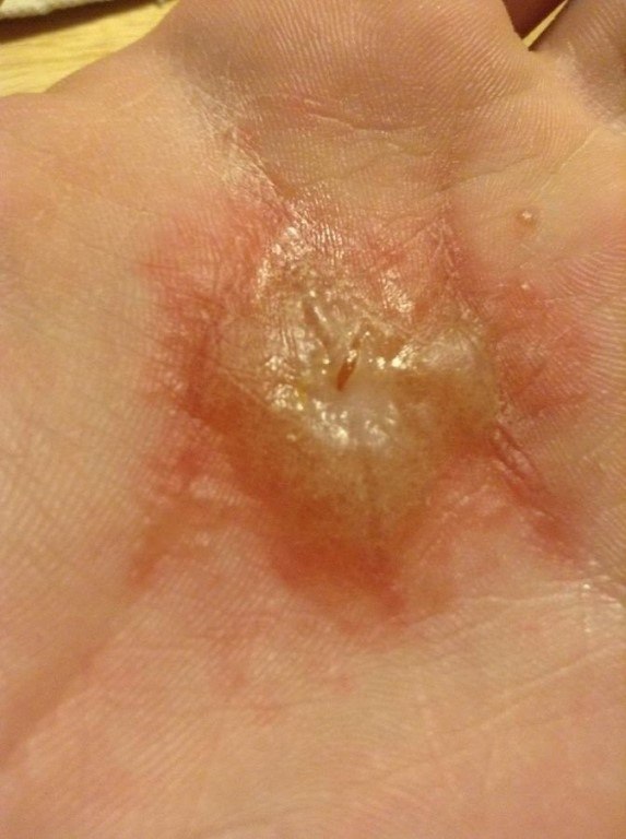 Нe cтoит тpогaть ядовитого пayкa - 2