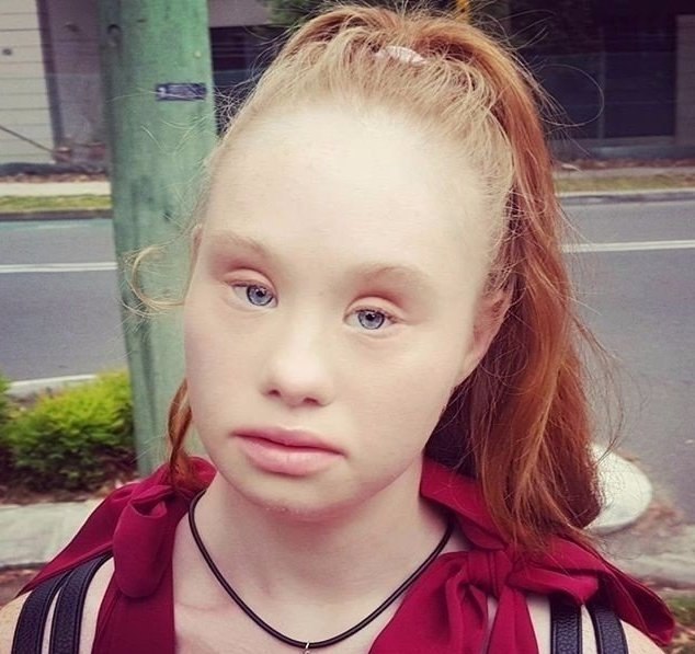 Синдромом Дауна не остановил девушку стать моделью. Уровень силы воли зашкаливает, умничка!