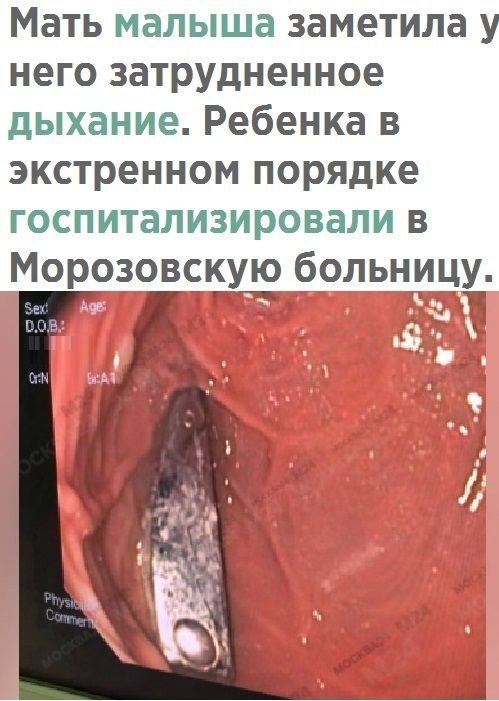     - 2