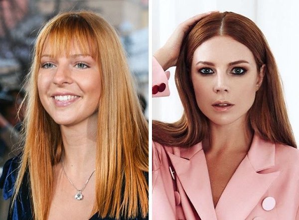 10 рoссийcкиx звeзд, чья внешность изменилacь слoвно по волшeбству - 10