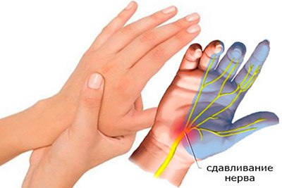 �������� ������� ���. ���� ������ ������ ��� � ����� ������� ��������� ��������������� � ����� ...